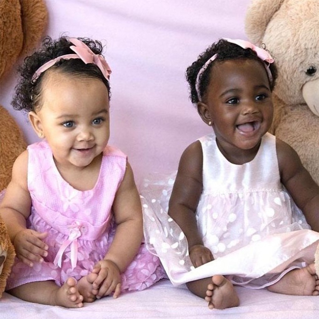 Twins with Varying Skin Tone: An Eye-Catching Distinctiveness That ...