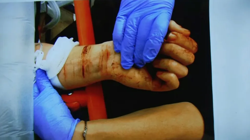 evidence photo of lindsay clancy's slit wrists