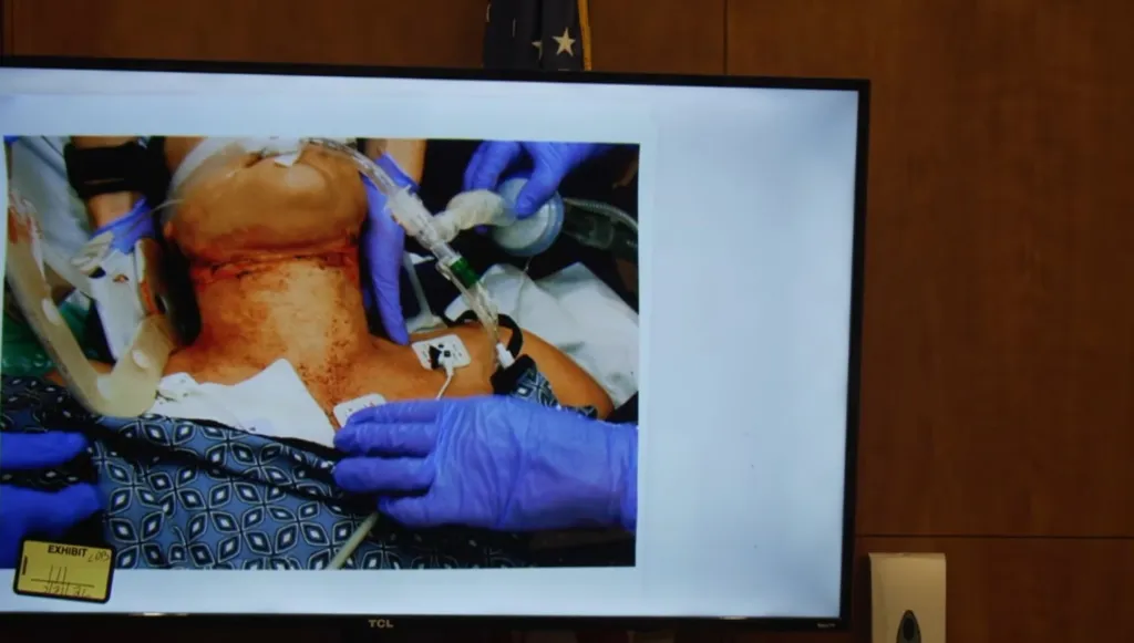 Photos showing Lindsay Clancy intubated in a hospital bed